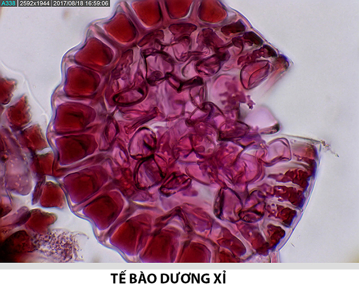 Kính hiển vi điện tử Dino-Lite AM7025X quan sát mẫu cây dương xỉ