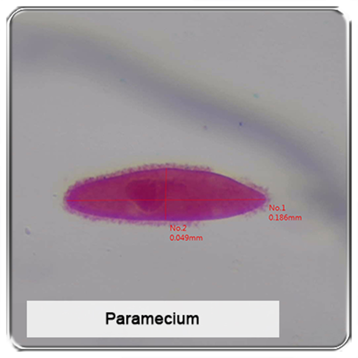 Hình ảnh quan sát trùng đế giày qua kính hiển vi Vitiny UM20B-CSZ064