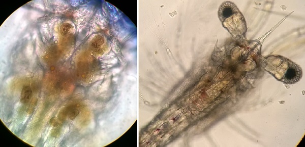 Hình ảnh ấu trùng tôm qua kính hiển vi sinh học