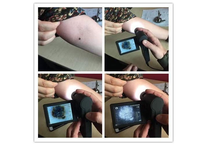 Ứng dụng của kính hiển vi kỹ thuật số UM049