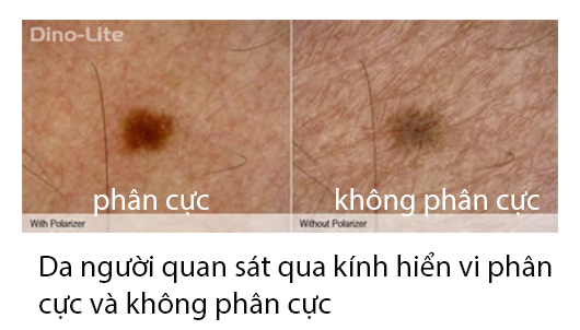 Ứng dụng của kính hiển vi phân cực AM4115ZTW