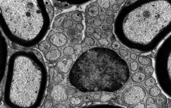 Kính hiển vi điện tử TEM hiển thị cấu trúc mẫu vật một cách rõ nét